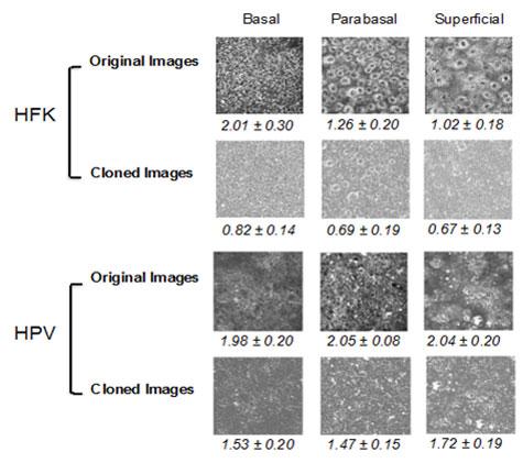 Representative original and D-O-C-corrected T-P-E-F images of superficial, para-basal, and basal layers of epithelial tissues made with healthy human foreskin keratinocytes and H-P-V-transfected keratinocytes with the average values for 5 different fields for each group displayed under each image with standard deviations
