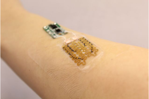An arm with a smart bandage on it