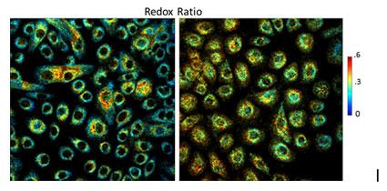 Redox ratio color coded images of healthy Human Foreskin Keratinocytes, and keratinocytes transfected with the H-P-V-16 E-7 oncoprotein