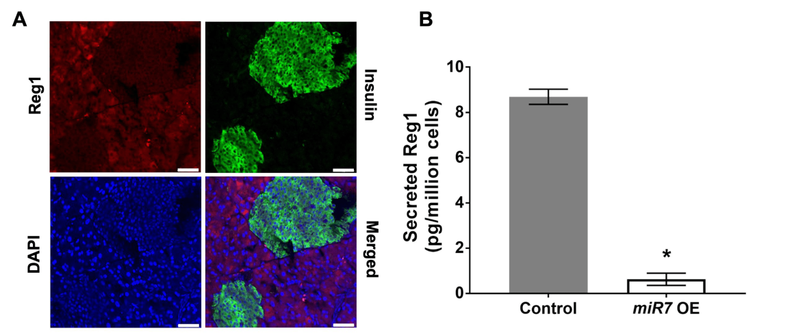(A) Mouse pancreatic tissue showing the expression of Reg1 protein. Insulin expression demarcates islets. Bars: 50 µm. (B) The production of Reg1 protein is curtailed in pancreatic acinar cells with over expression of microRNA-7 (miR7 OE). *p<0.05.