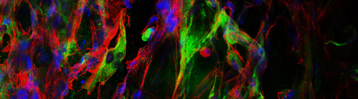 3D fluorescence image of murine fetal cortical neurons (red) and astrocytes (green) co-cultured in a silk scaffold. Image taken in Tufts Advanced Microscopic Imaging Center. (O. Lyaudanskaya)