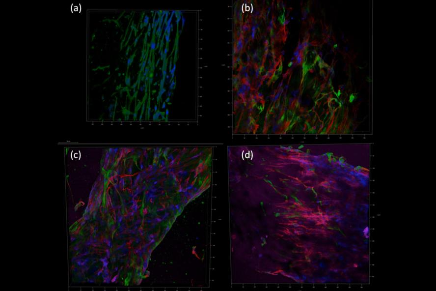 3D fluorescence images of: (a) stained muscle cells; (b-d) co-cultures of nerve stem cells (green) and muscle cells (pink, red). (Photo: Tom Dixon)