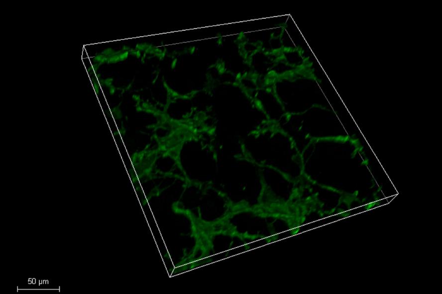 3D Fluorescence image of cerebellar neurons
