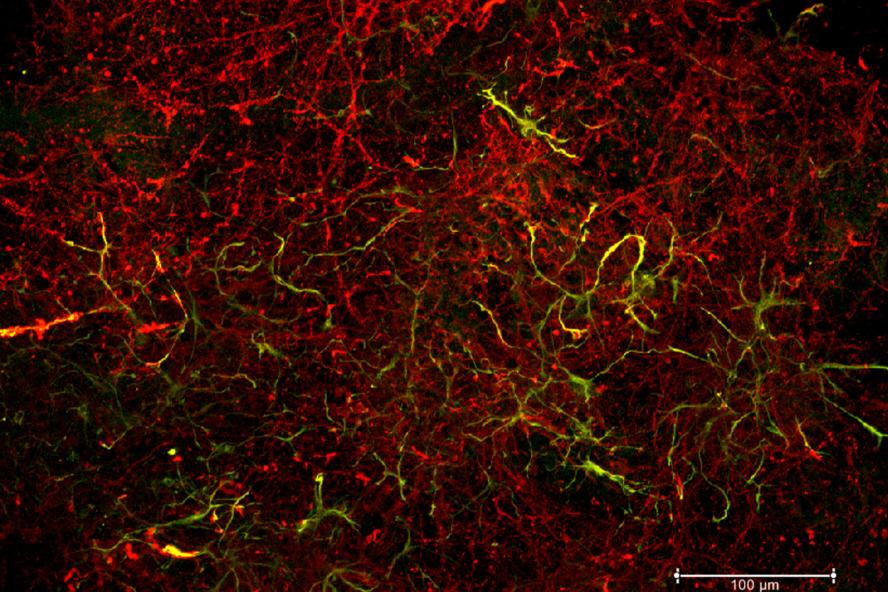 3D fluorescence image of a co-culture of murine fetal cortical neurons and astrocyte