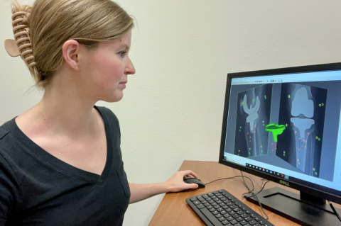 Abby Niesen examines an x-ray of a knee. She is responsible for a break-through discovery in the reporting of systematic errors being collected by orthopedic researchers.