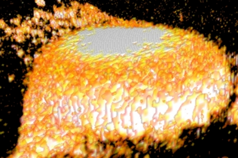 A 3D projection from a calcific nodule grown in a cell culture model of valve disease.