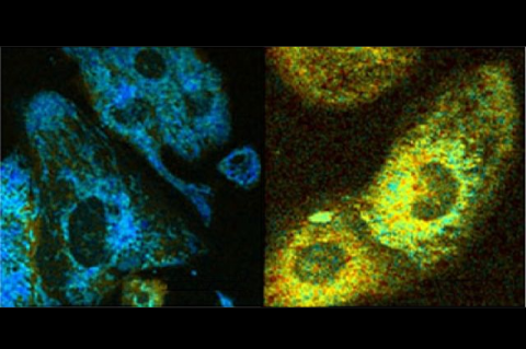 Cell fluorescence reveals metabolic activity